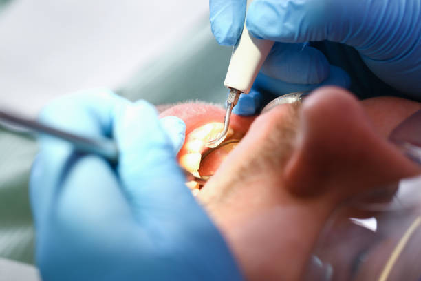Best Broken Tooth Emergency  in Whitwell, TN